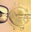 { MEDICAL BREAKTHROUGH IN UK } EIGHT HEALTHY BABIES HAVE BEEN BORN USING THIS TECHNIQUE Babies born from 3 people's DNA are free of genetic diseases