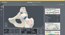 Knee and hip Arthroscopy by a US surgeon now in Delhi