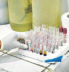 India on course to developing first indigenous dengue vaccine