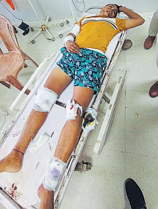 Two accused injured in gunfight with cops