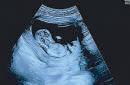 Pete Davidson is going to be dad, expecting first child with girlfriend