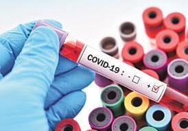 No cause for concern yet in India: Experts