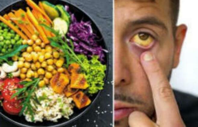 Diet for jaundice: Foods to eat and foods to avoid