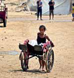 Malnourished kids arrive daily at Gaza hospital