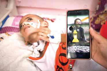 A boy in Gaza with brain damage fights for his life amid blockade