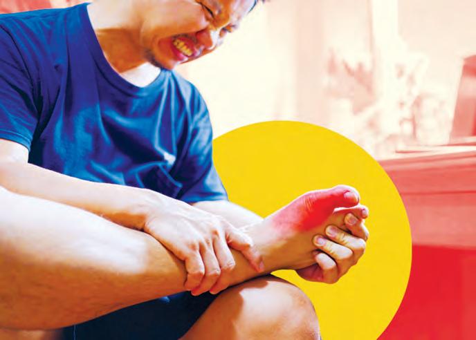 Is your uric acid high?