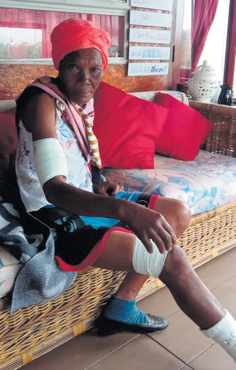 Woman seriously injured in pack dog attack