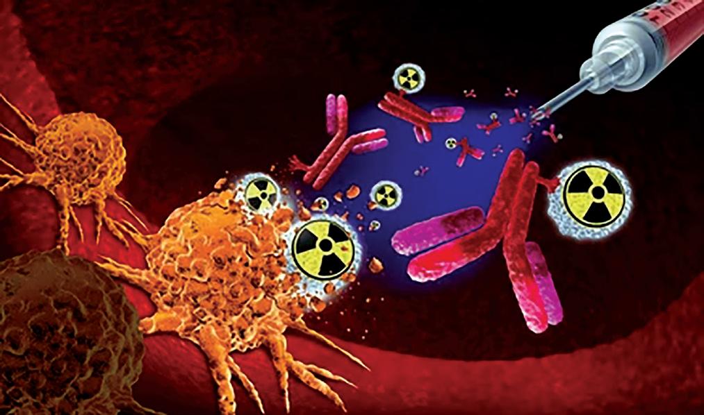 Theranostics, a groundbreaking approach in oncology