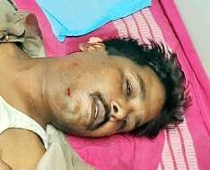 பைக் மீது அரசு பேருந்து மோதி போலீஸ்காரர் காயம்!