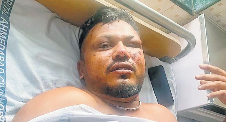 Lone Survivor Tale of 'Vishwas' in Fate
