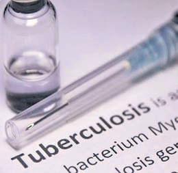 Genome factor behind very high TB burden among tribal groups in MP