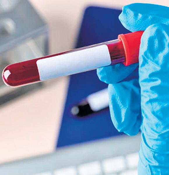 5 kids HIV+ after blood transfusion in Jharkhand; civil surgeon suspended