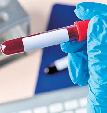 5 kids HIV+ after blood transfusion in Jharkhand; civil surgeon suspended