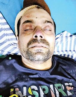 கோவையில் சுட்டுப்பிடிக்கப்பட்ட உ.பி. கொள்ளையர்களில் ஒருவர் உயிரிழப்பு