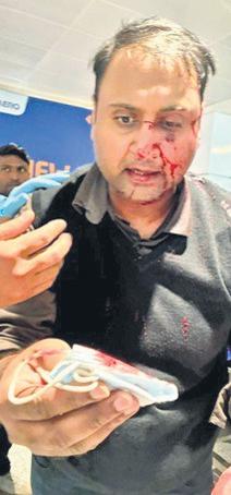 No formal complaint yet, say police in passenger’s assault at airport; AIX pilot removed