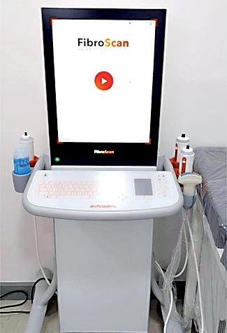 DIMO Healthcare delivers first Echosens FibroScan Expert 630 to Hemas Hospital