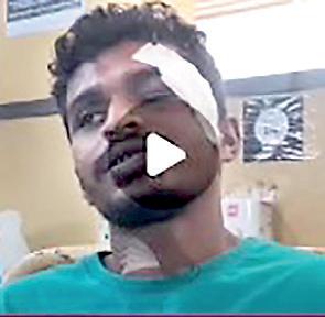 I am happy to be able to save the lives of several people despite being injured: SF soldier