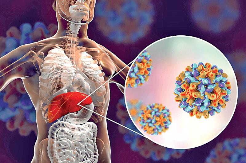“Hepatitis B virus never leaves patient’s liver – ever”: Dr. Girn