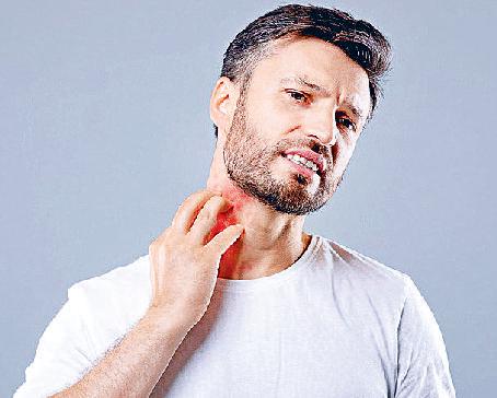 मानसून में स्किन प्रॉब्लम्स बचाव के लिए बरतें सावधानी