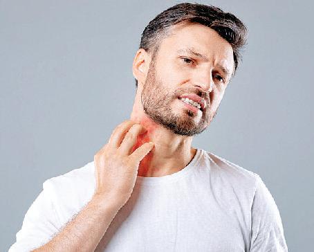 मानसून में स्किन प्रॉब्लम्स बचाव के लिए बरतें सावधानी