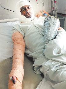 पीआईएल फर्नेश ब्लास्ट में एक और मजदूर की मौत