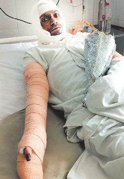 पीआईएल फर्नेश ब्लास्ट में एक और मजदूर की मौत