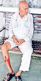 टोहानाः सैर पर निकले बुजुर्ग को कुत्तों के झुंड ने काटा