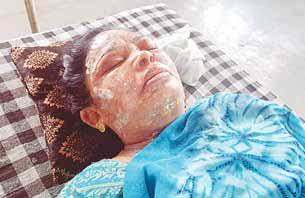 कुकर ब्लास्ट होने से टिफिन सेंटर संचालक महिला घायल