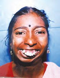 முக அறுவை சிகிச்சை மருத்துவரின் முத்தான அனுபவங்கள் - 2 மந்திரம் திறக்க முடியாத வாயை மருத்துவம் திறந்து விட்டது