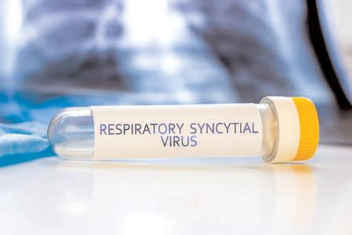 Children with chronic conditions at risk for severe RSV outcomes: Study