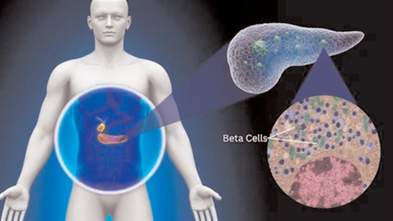 Protein abundant in human body worsening diabetes: IIT Bombay study