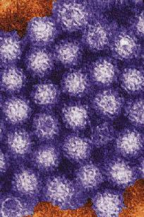 Hospitals vomiting bug cases rise again