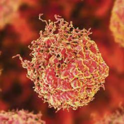 Prostate now most common cancer