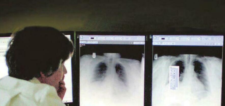 NHS must make greater use of AI