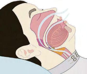 Smart PJs can diagnose sleep disorders