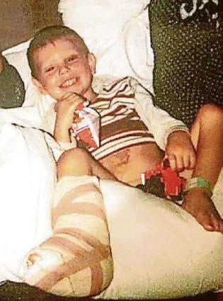 One-legged cricketer stripped of benefits