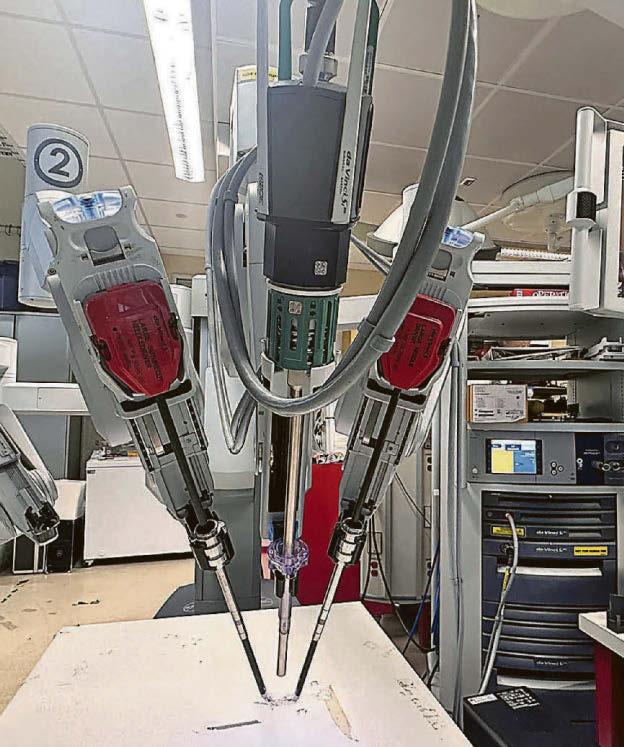 Robo-surgeon does first solo operation