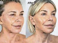 Leslie Ash: Face plan changed my world