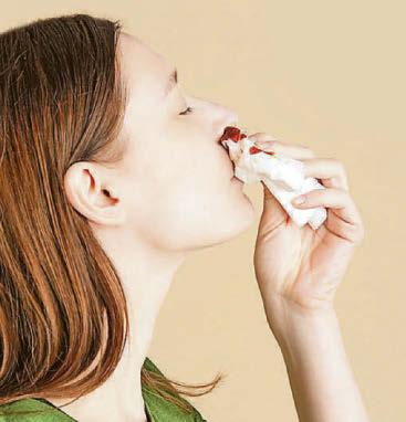 BE ON YOUR GUARD IF YOU GET NOSEBLEEDS
