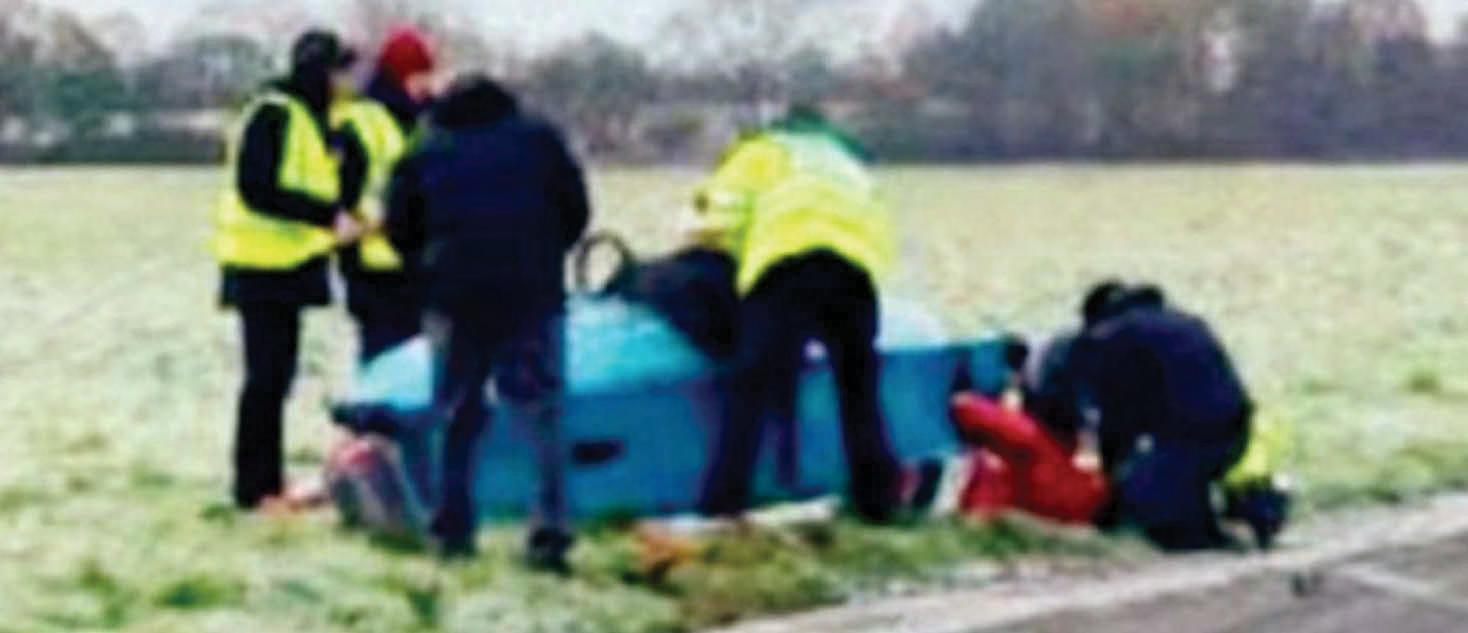 I'M NOT TRYING TO HIDE SCARS