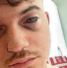 Bladdered on Ket