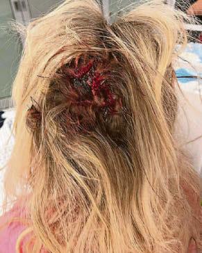 Nurse beaten with a crowbar at work