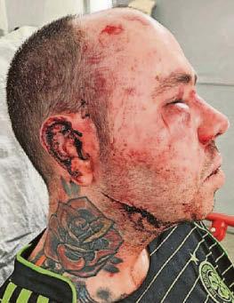 HOME ROBBERY SLASH ATTACK