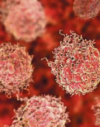 'Glow' scans for prostate cancer could end biopsies