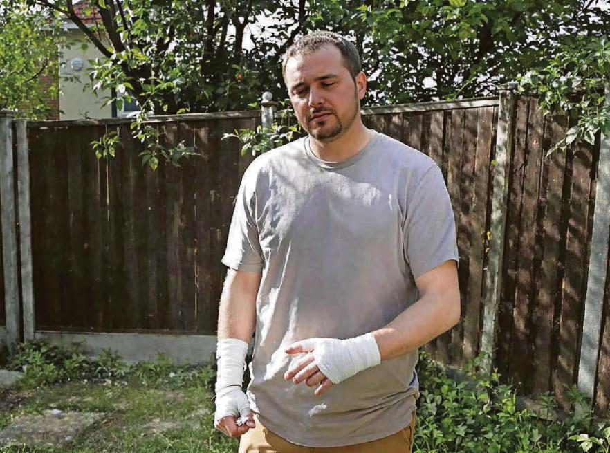 Firework hell leaves dad in crippling pain