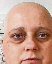 I hid from the world when cancer changed my body until dancing transformed my life...