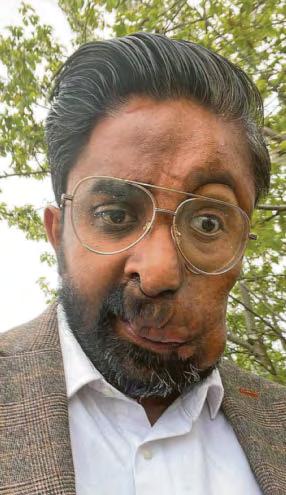 Disfigured man refused coffee 'due to his face'