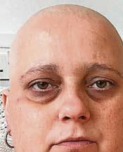 I hid from the world when cancer changed my body until dancing transformed my life...