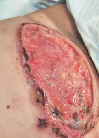 Hull woman is left 'bed-bound' following plastic surgery abroad