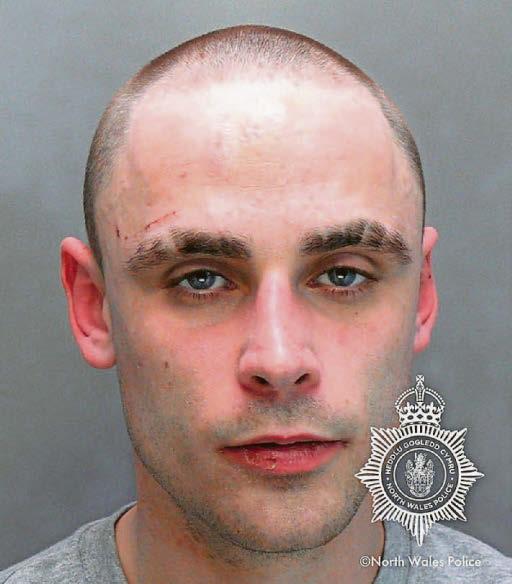 Police union slams sentence for thug who bit one cop and spat in the face of another